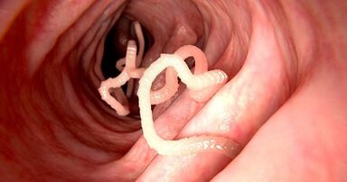As causas dos parasitos no corpo humano