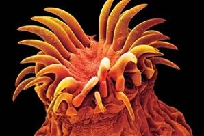 Parasitos trematodos en humanos